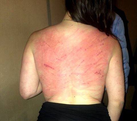 %d8%a8%d8%a7%d8%b2%d8%af%d8%a7%d8%b4%d8%aa-%d9%88-%d8%b4%d9%84%d8%a7%d9%82-%d8%b2%d8%af%d9%86-%d9%88%d8%ad%d8%b4%db%8c%d8%a7%d9%86%d9%87-%d8%af%d8%ae%d8%aa%d8%b1-%d8%af%d8%a7%d9%86%d8%b4%d8%ac%d9%88